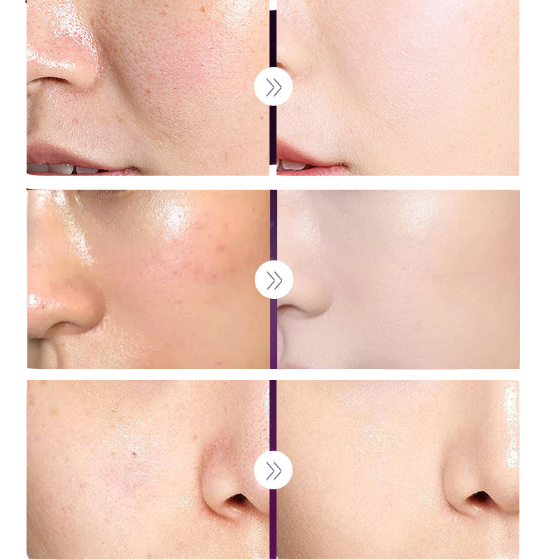 女性のための真珠の美白クリーム,豪華な保湿デイクリーム,老化 - Luxury Skincare & Spa Photos のレビューと価格